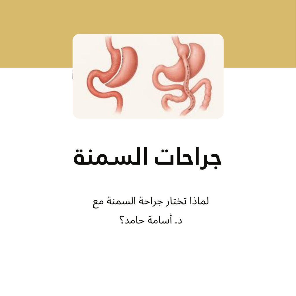 أفضل جراح تكميم المعدة تحويل مسار عملية السمنة