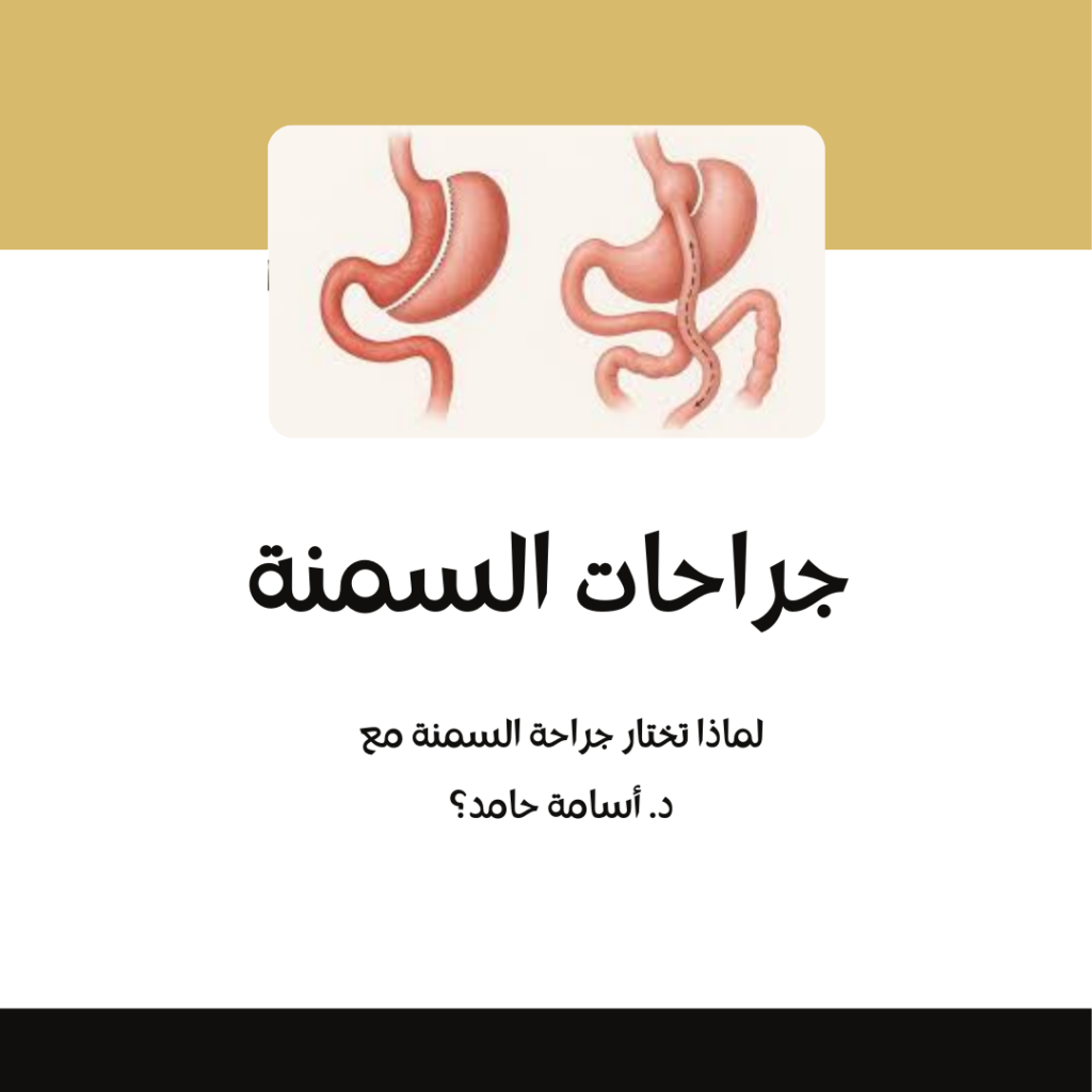 أفضل جراح تكميم المعدة تحويل مسار عملية السمنة